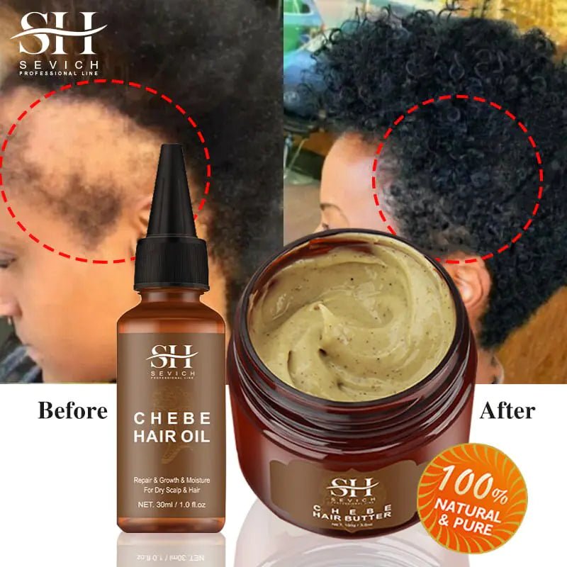 Alopecia Treatment Oil Natural Crazy Hair Regrowth - Organic Beauty Solution