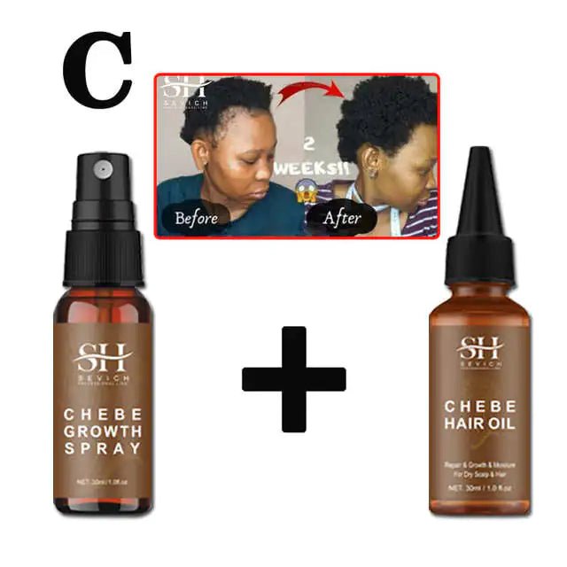 Alopecia Treatment Oil Natural Crazy Hair Regrowth - Organic Beauty Solution