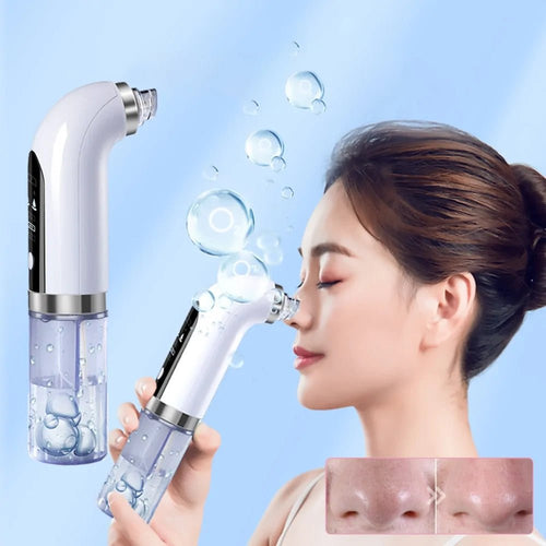 Blackhead Remover Device - 