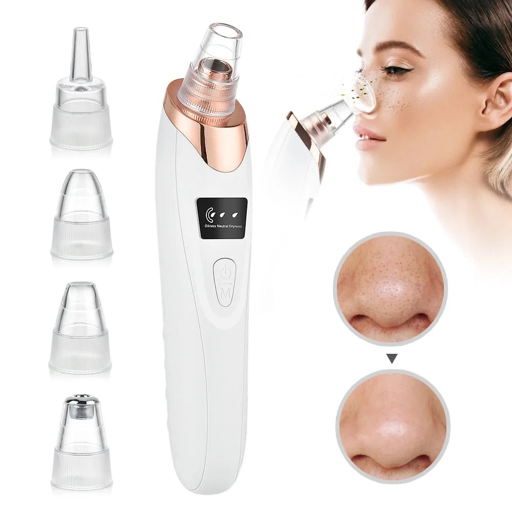 Blackhead Remover Vacuum Acne Pimple Black Spot - Organic Beauty Solution