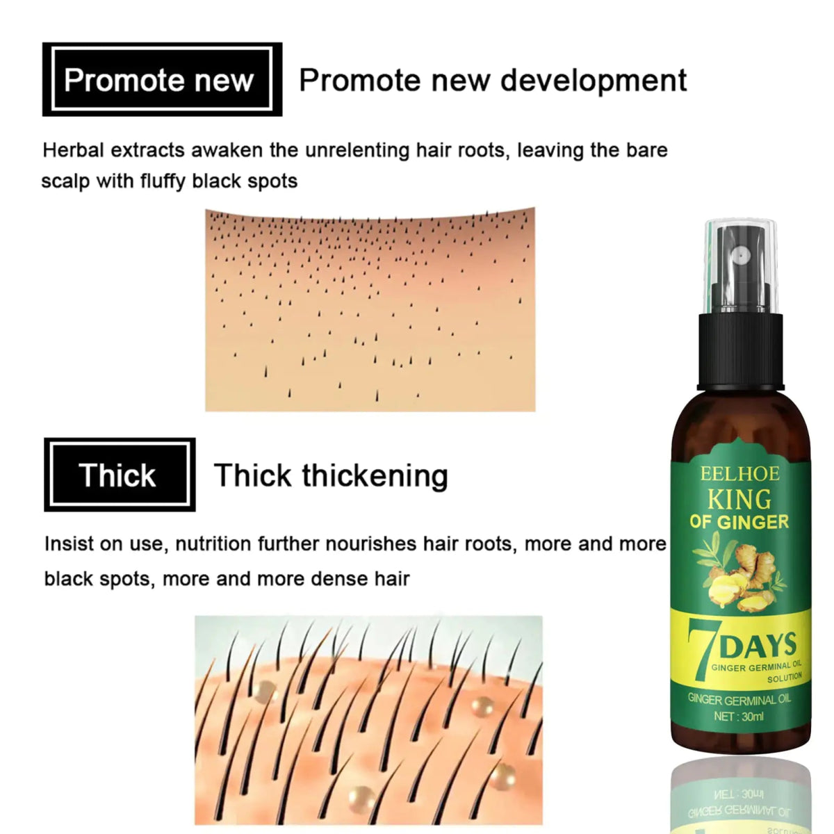 Ginger Hair Growth Serum Sprayer Hair Regrowth - Organic Beauty Solution