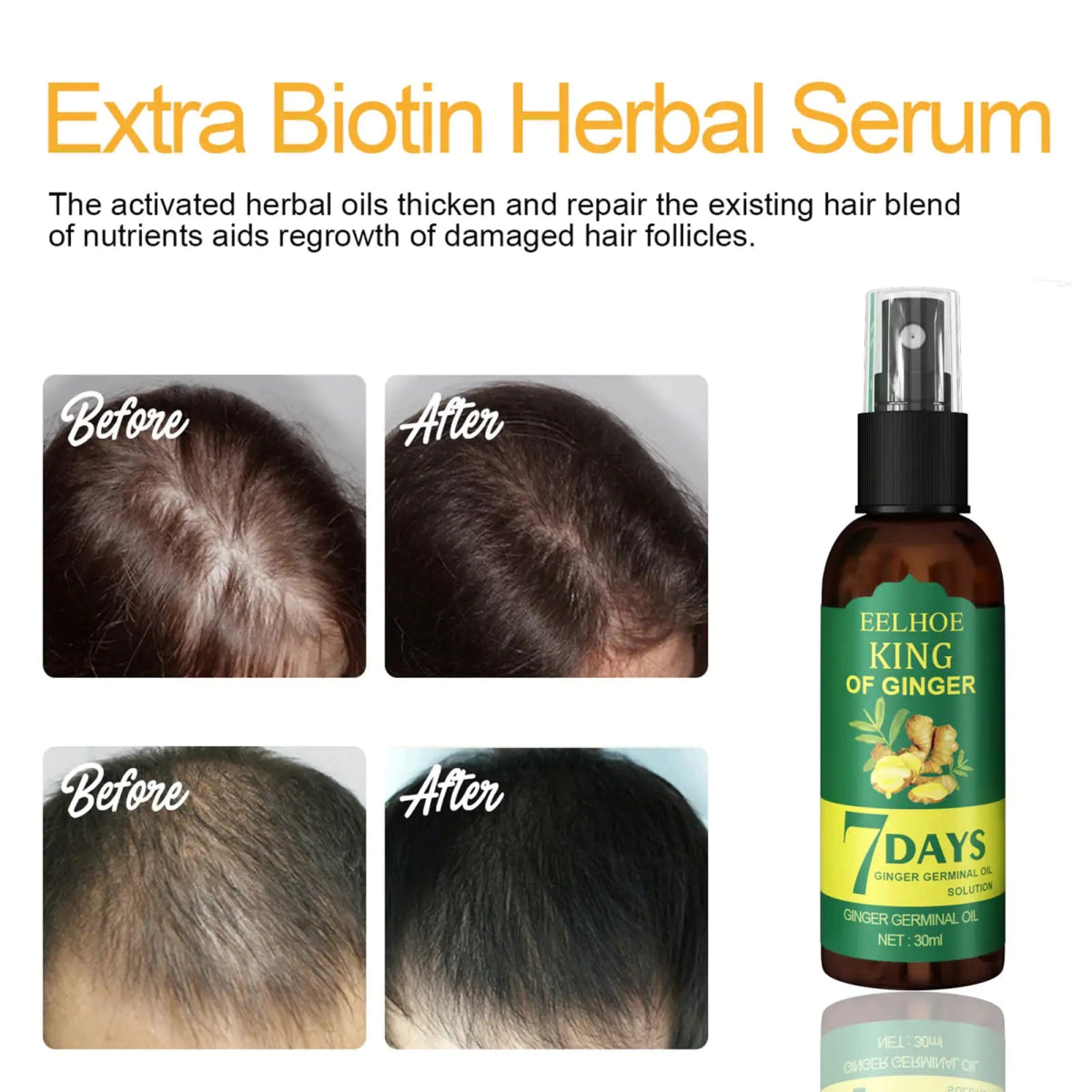 Ginger Hair Growth Serum Sprayer Hair Regrowth - Organic Beauty Solution