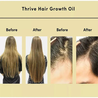 Thrive Hair Growth Essential Oil Hair - Organic Beauty Solution