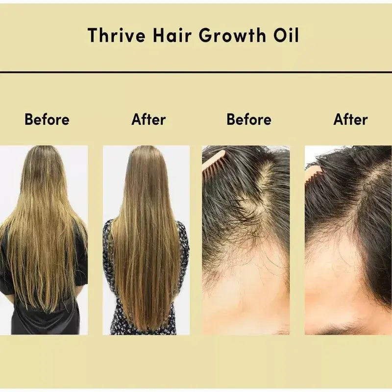 Thrive Hair Growth Essential Oil Hair - Organic Beauty Solution