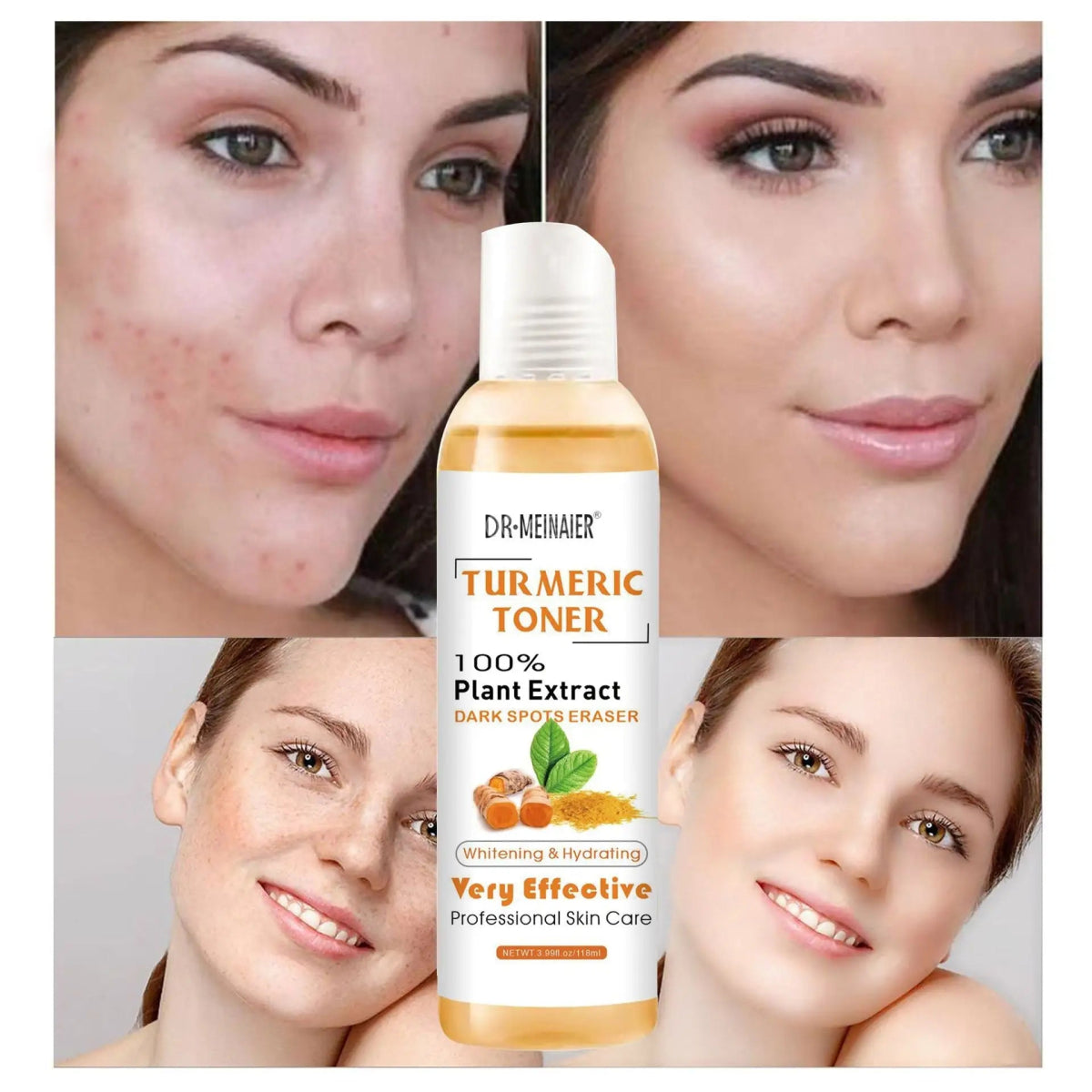 Turmeric Moisturizing Toner Acne Remover - Organic Beauty Solution