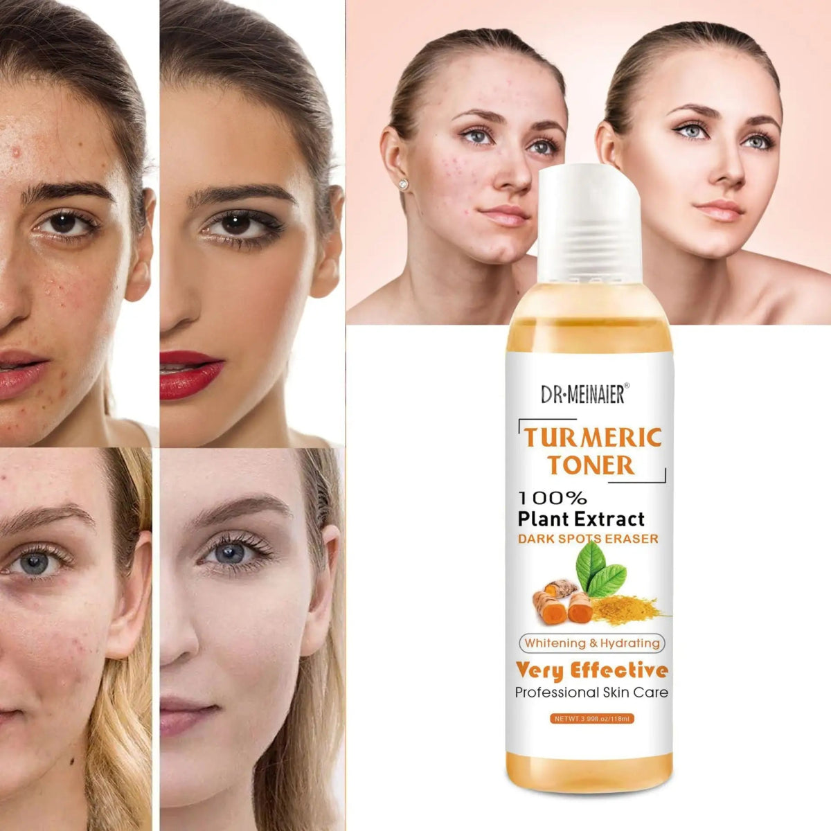 Turmeric Moisturizing Toner Acne Remover - Organic Beauty Solution