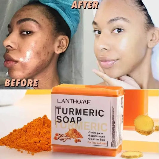 Turmeric Soap Face Cleansing Anti Acne - Organic Beauty Solution